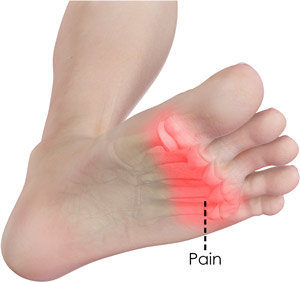 Forefoot Pain  